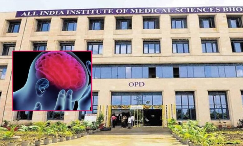 aiims-भोपाल-की-बड़ी-उपलब्धि:-24-घंटे-में-होगा-स्ट्रोक-का-एडवांस्ड-इलाज,-ब्रेन-का-थक्का-होगा-दूर