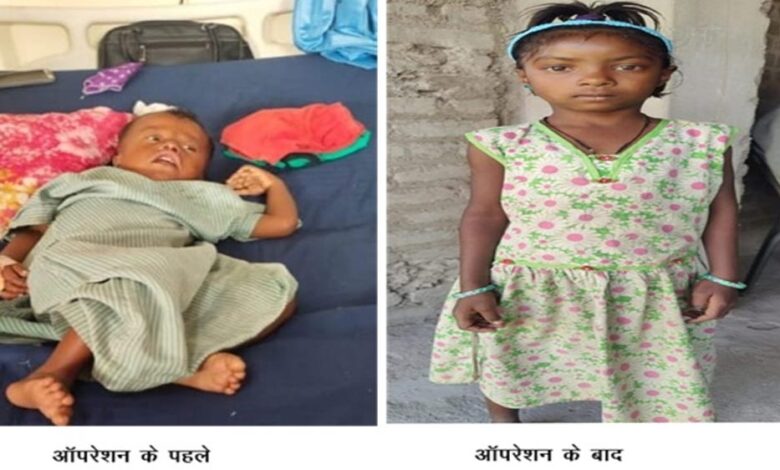 रायपुर-:-चिरायु-योजना-बच्चों-के-लिए-भी-बनी-वरदान